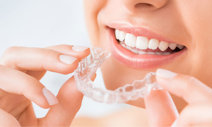 Clear Aligners (Invisalign® Provider) Clear Aligners (Invisalign® Provider) treatment at Designer Smiles dental clinic in Vile Parle East, Mumbai