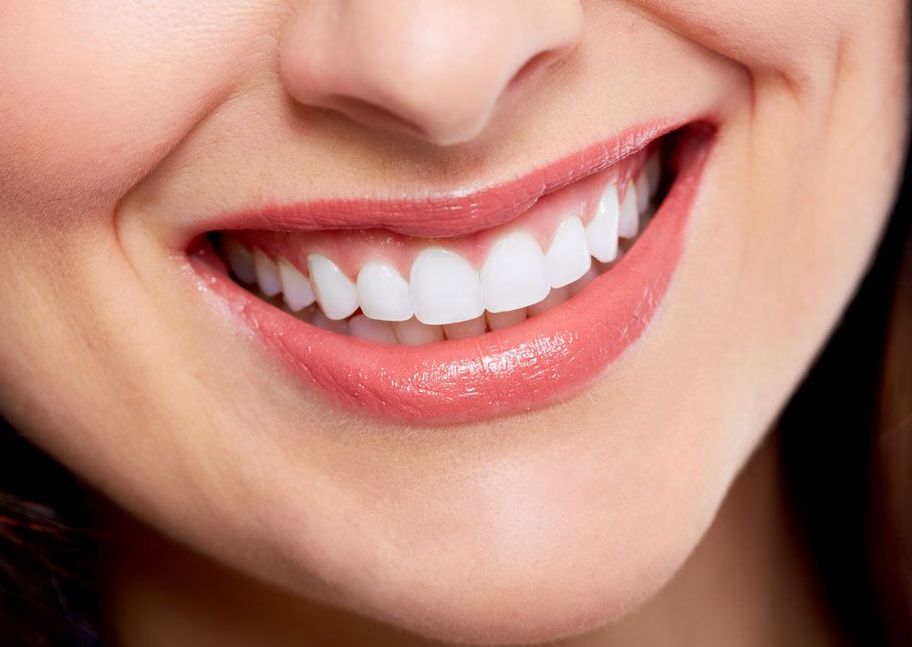 Smile Makeover Smile Makeover treatment at Designer Smiles dental clinic in Vile Parle East, Mumbai
