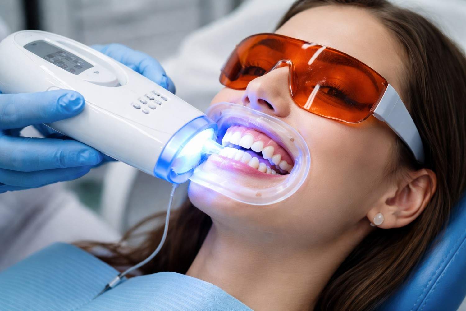 Teeth Whitening Teeth Whitening treatment at Designer Smiles dental clinic in Vile Parle East, Mumbai